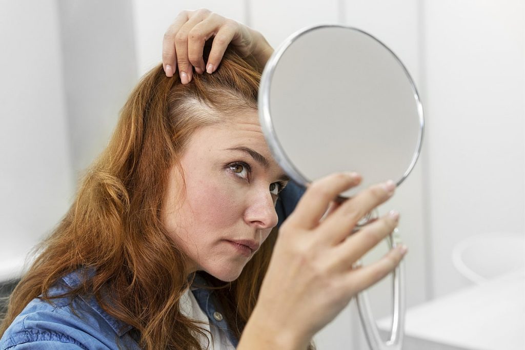 tipos productos caída cabello